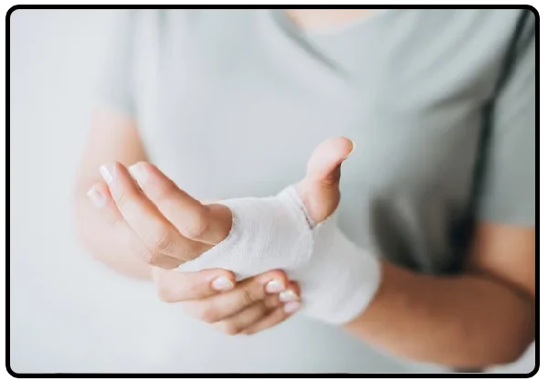 Fracture